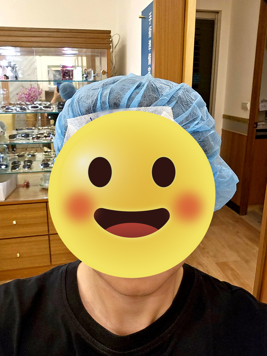 Smart Pro近視雷射